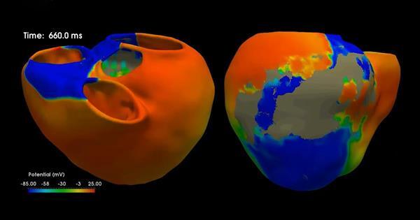 技嘉伺服器算力爆發 助西班牙胡安卡洛斯國王大學抗老研究