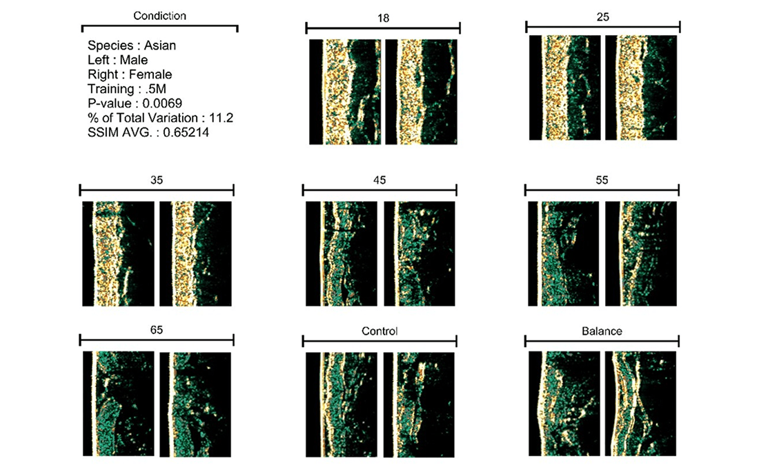 ▲ Skin image matrix trained on the AI TOP 100, covering skin condition prediction for Asian males and females aged 18 to 65